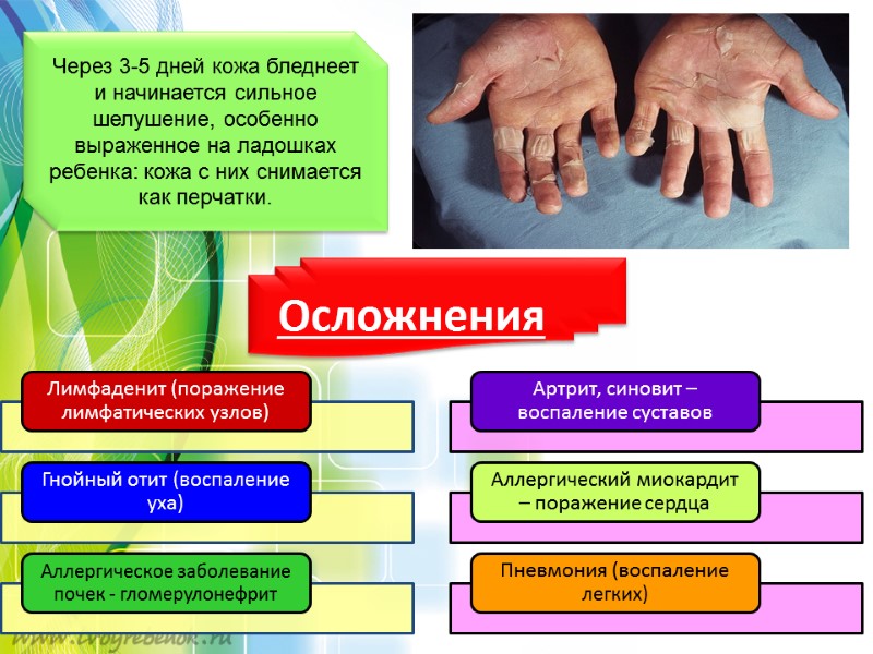 Через 3-5 дней кожа бледнеет и начинается сильное шелушение, особенно выраженное на ладошках ребенка: